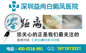 深圳白癜风疾病预防的方法有什么？